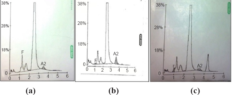 Association of BCL11A genetic variant (rs11886868) with severity in β-thalassaemia major & sickle cell anaemia