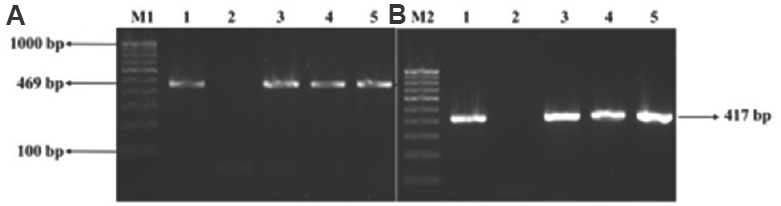 Plasmid-mediated fluoroquinolone resistance associated with extra-intestinal Escherichia coli isolates from hospital samples