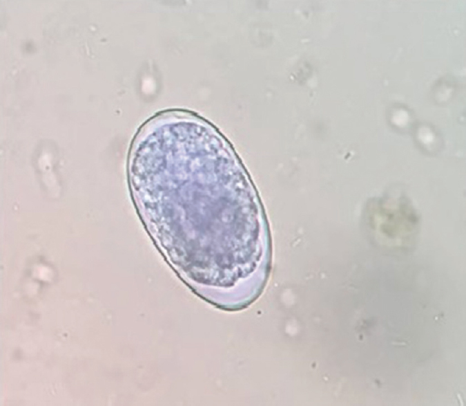 Evaluation of various culture techniques for identification of hookworm species from stool samples of children