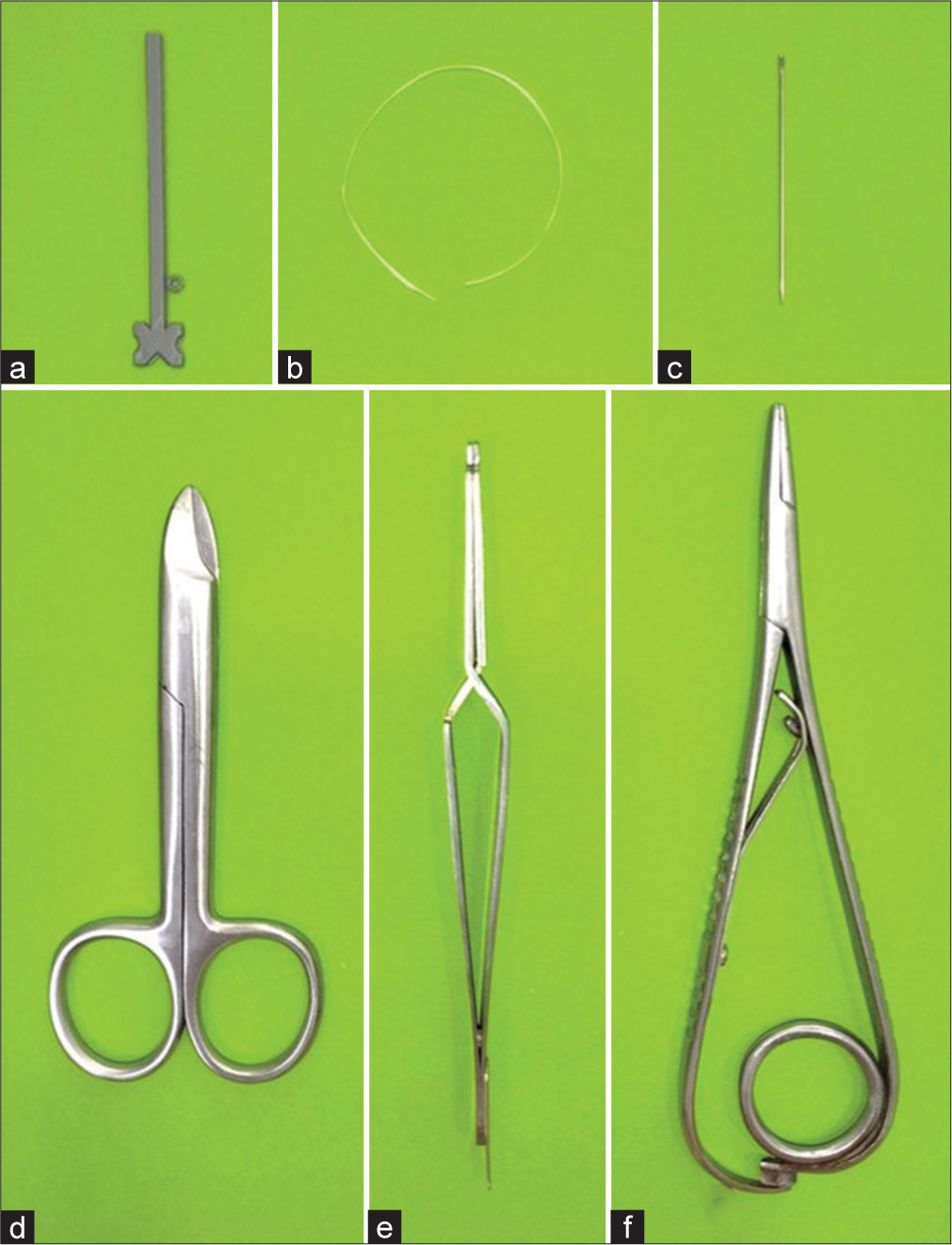 Innovative and simple technique of stabilizing the lingual retainer wire before bonding