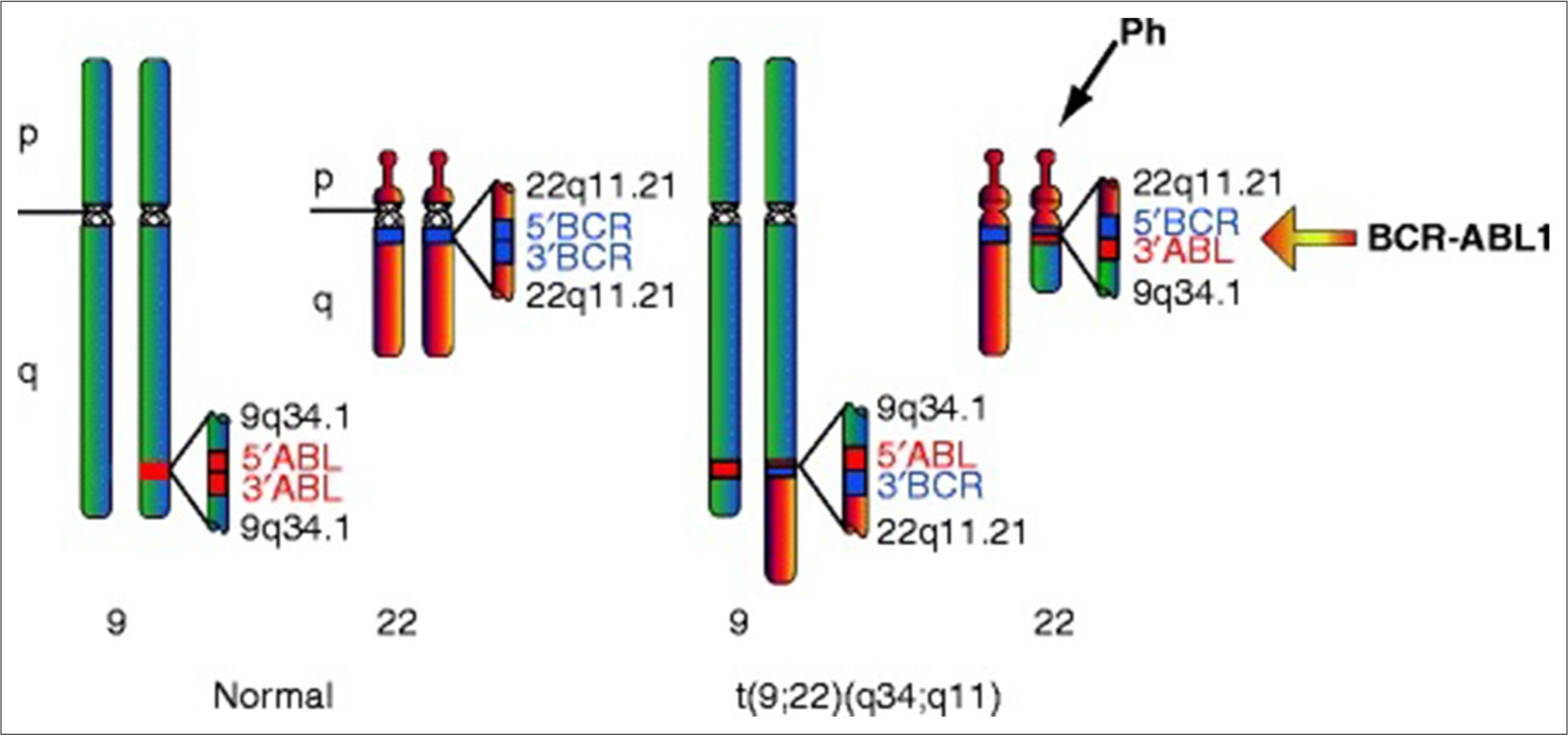 Genetic diversity and variation in chronic myeloid leukemia patients of Indian origin- Implications for treatment response and prognosis