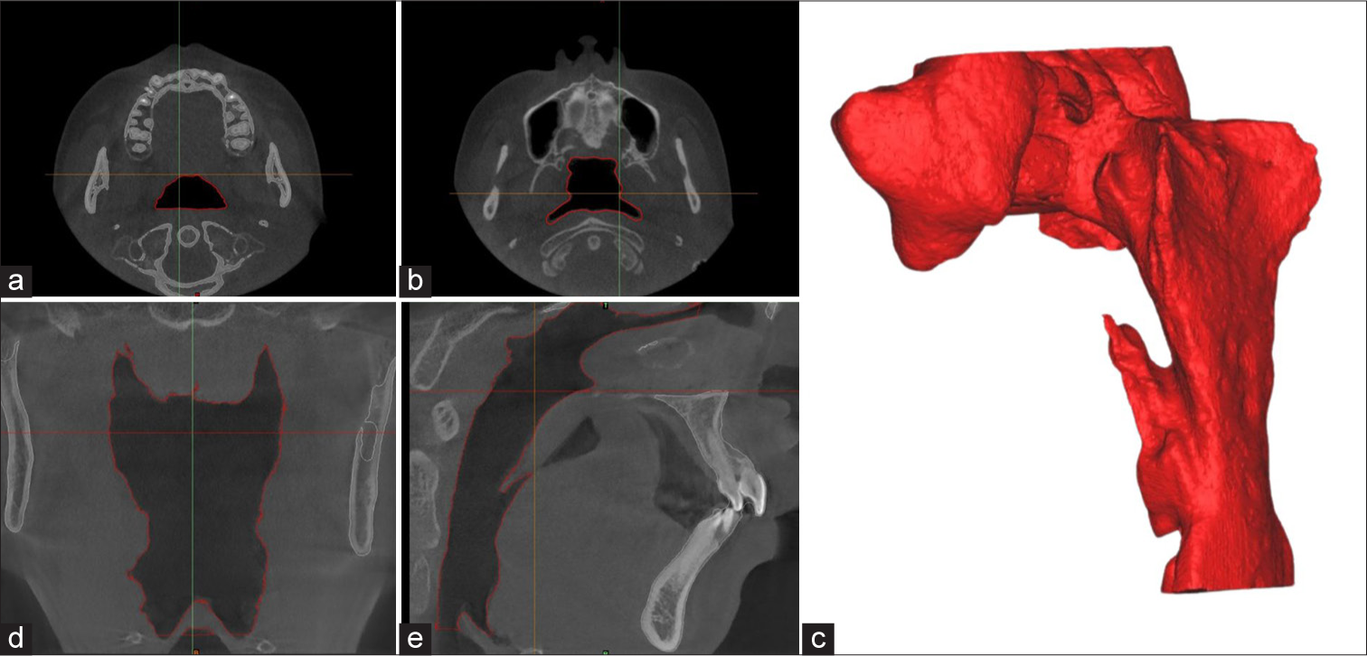 Preliminary study: Evaluating the reliability of cone-beam computed tomography images for upper airway volume in orthodontics