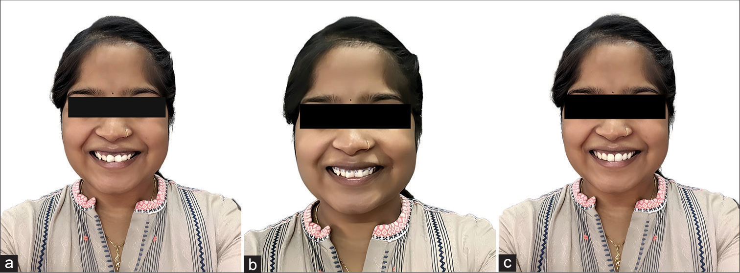 Evaluation of augmented reality and social media on patient motivation to undergo fixed orthodontic treatment